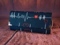 EKG